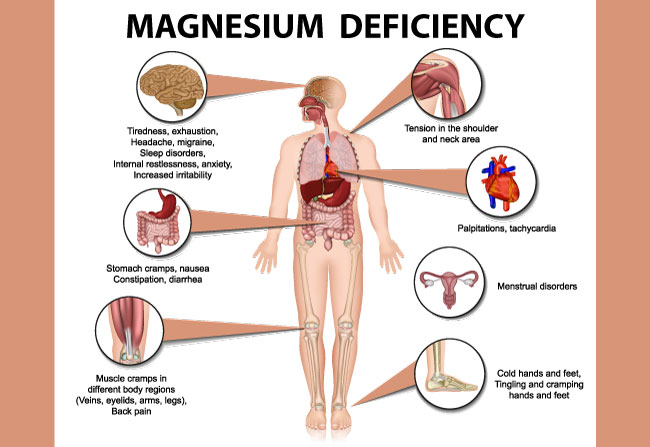 Magnesium Deficiency-DEFICIENCY Magnesium Deficiency